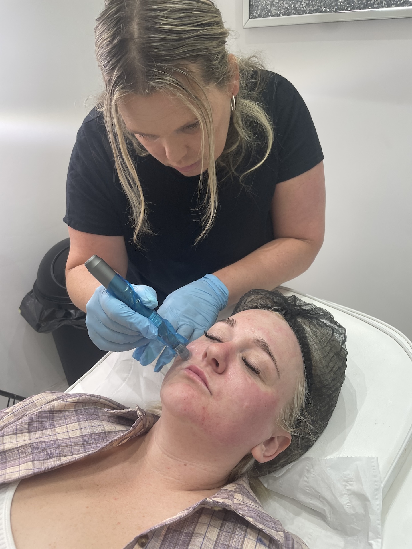 Kerry using the micro needling tool on client